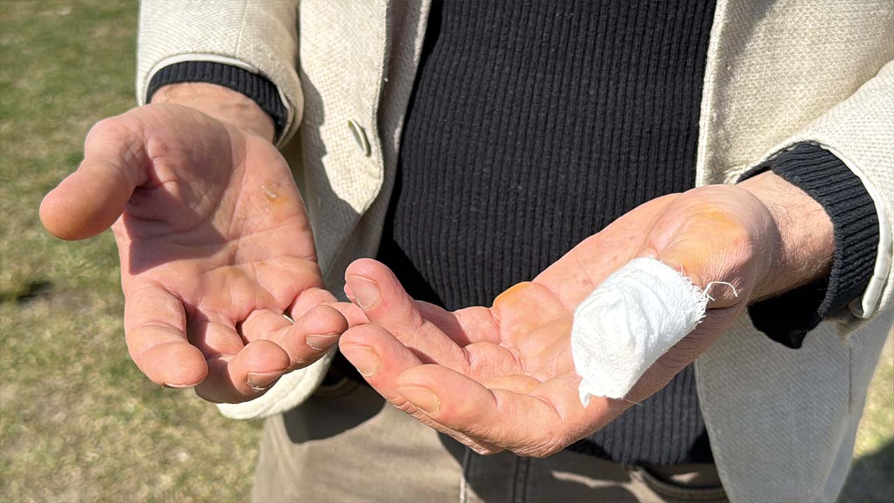 Karabük’te parkta köpeğini gezdiren Yalçın Açıkgöz, sahipsiz pitbull cinsi köpeğin